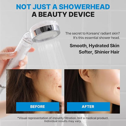 Essential Everyday Shower Ritual Elevating Korea’s Beauty Legacy – High-Purity Sediment Filters for Softer Skin & Smoother Hair | 1 Year Advanced Filtration Set (JNE100-SET-1YR)