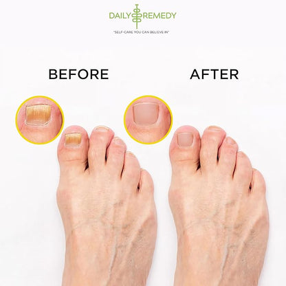 Citrus Detox Foot Soak with Epsom Salt - for Foot Callus, Immune Boost, Damaged Toenail, Athletes Foot, Pedicure and Soothes Tired Feet - Made in USA