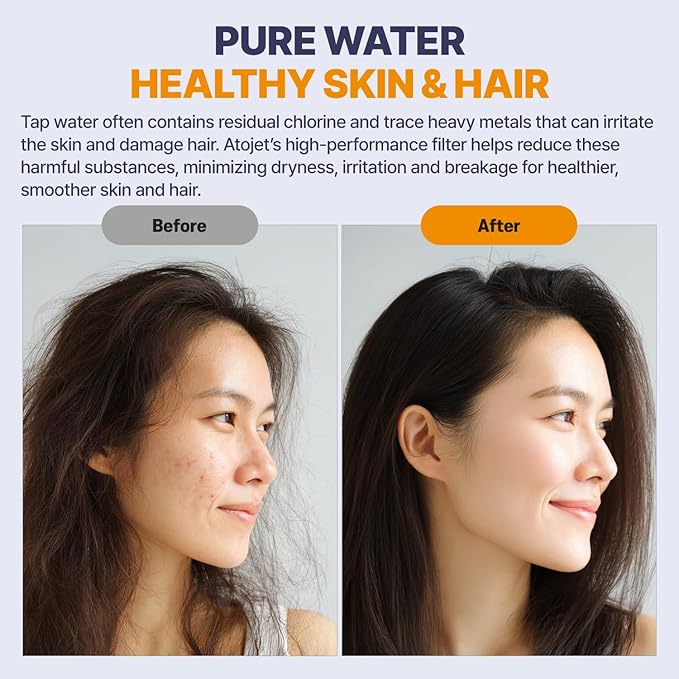 Aqua Detox Shower Filter By Korean Technology - Relieves Dryness and Irritation While improving Skin and Hair Health - White (JNE600W-SNG-DTX)
