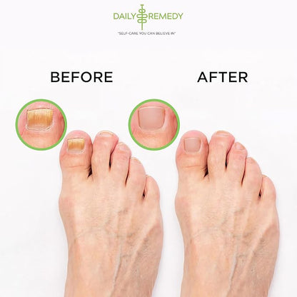 Tea Tree Oil Foot Soak with Epsom Salt - Made in USA - for Toenail irritations, Athletes Foot, Stubborn Foot Odor Scent, Softens Calluses & Soothes Sore Tired Feet - 2 Pack