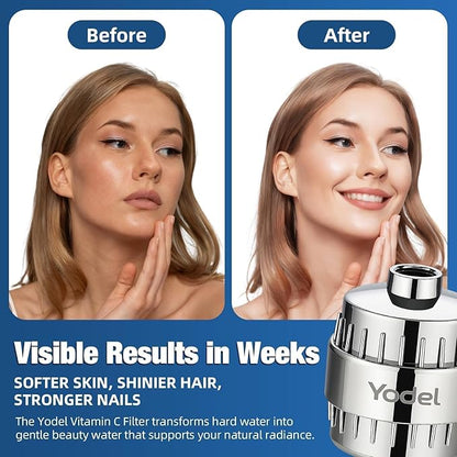 Yodel Shower Filter for Hard Water - 25 Stage Shower Head Filter Removes Chlorine for Hair and Skin, Reduces Dry Skin, Dandruff and Hair Damage, Universal High Output Water Filter,Chrome