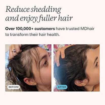 MDhair Mounted & Handheld Filtered Showerhead Set for Healthier Hair & Skin - Multi-Stage Filter Removes Chlorine & Heavy Metals, Dermatologist-Formulated Shower Head Filter for Hard Water