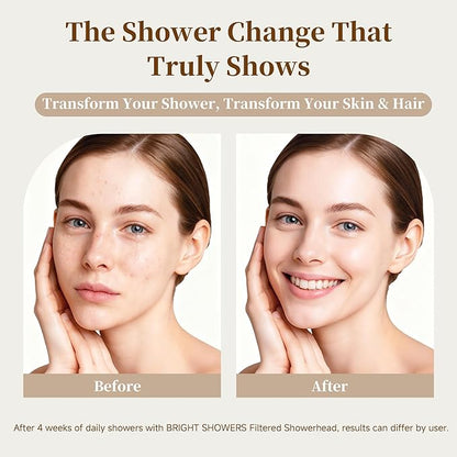 BRIGHT SHOWERS Filtered Shower Head, High Pressure Fixed Showerhead for Hard Water, Dual-Media Filter Removes Chlorine & Impurities, 8 Spray Modes, Oil Rubbed Bronze