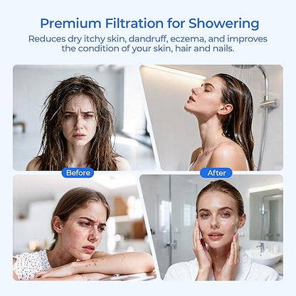 R24162-NA Showerhead Filter Replacement, Compatible with Kohler Aquifer Filtered Showerhead R24670 or Kohler Aquifer Shower Filter R24612, 2 Pack