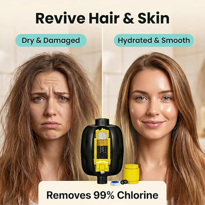 Shower Water Filters with Vitamin C– Removes Chlorine, Heavy Metals & Impurities, Softens Hair & Skin, Eczema Relief, Easy Installation, Long-Lasting Cartridge – by Tylola