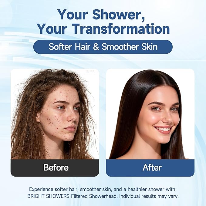 BRIGHT SHOWERS Shower Filter Replacement for Handheld Shower Head, 2 Pack Shower Hard Water Filter for Remove Chlorine and Harmful Substances
