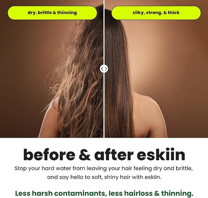 Eskiin Filtered Shower Head - Best Shower Head With Filters For Healthy Hair & Skin - High Pressure Water Softener For Hard Water - Reduce Dandruff, Protect Colored Hair, And Soothe Dry Skin (Black)